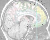 mri xray brain anatomy skull cerebrum cerebellum head mind human medicine technician imaging